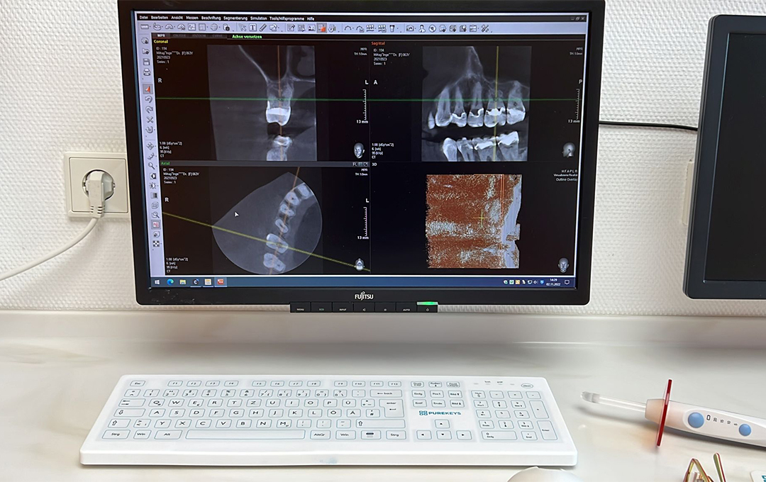 Digitale Volumentomographie und Diagnostik | ZahnärzteTeam Parkallee MVZ